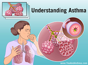 Slide Show - Understanding Asthma